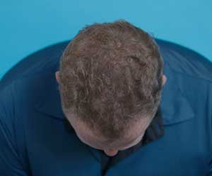 Hair Grow Max 2x1 a 20.021,60 HUF