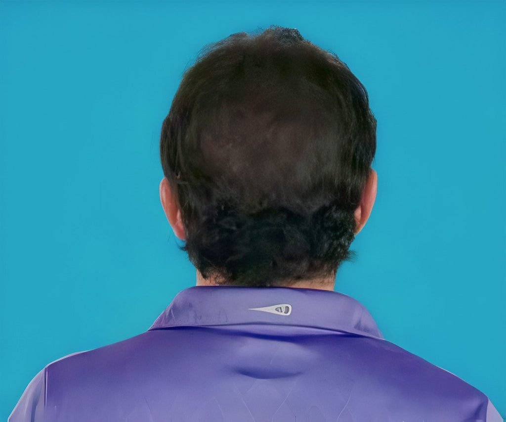 Hair Grow Max 2x1 a 214 PLN